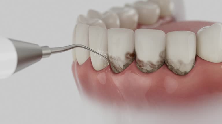 Trusted Teeth Cleaning And Checkup service in Wonder Lake, IL - Dentist Open Now